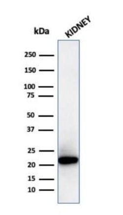 Ferritin Light Chain Antibody (FTL/3872R) - Azide and BSA Free, Novus Biologicals 100 &mu;g | Buy Online | Novus Biologicals | Fisher Scientific